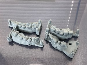 🌟 iOS受注 …☝️保険〜自費まで✨優秀なデジタル担当主任が(ほぼ)無調整の技工物を可能にします✨